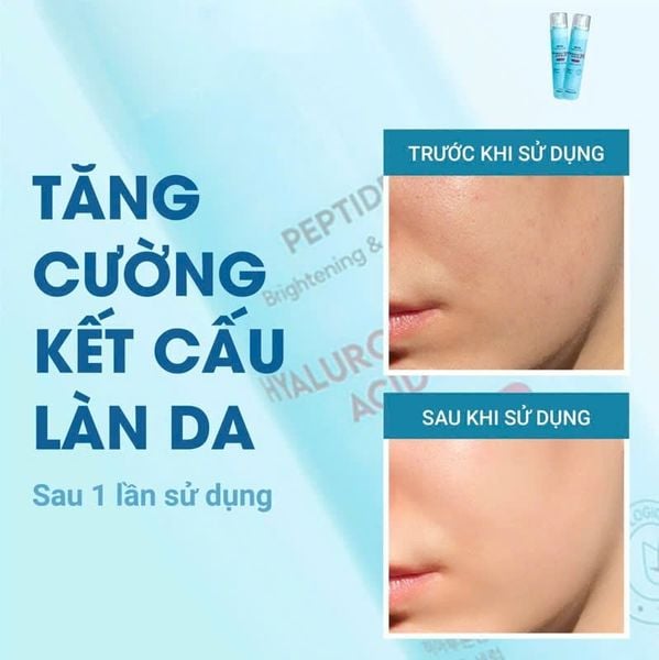 Tinh Chất Dạng Xịt ShinCos.Lab Hyaluronic Acid B5 3% Mist Serum 120ml