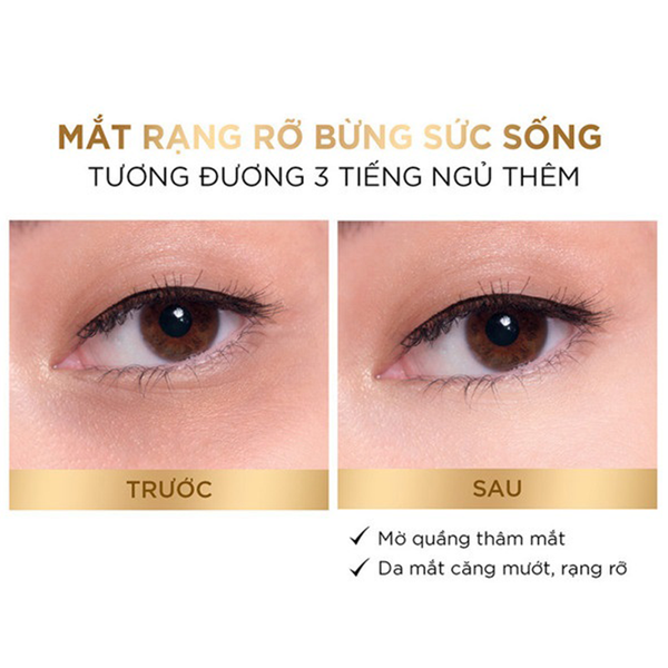 (HSD: 9/2026) Tinh Chất Dưỡng Sáng Giảm Quầng Thâm Vùng Mắt Loreal Paris Glycolic Bright Dark Circle Eye Serum 20ml