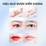Nước Tẩy Trang Dành Cho Da Nhạy Cảm & Đang Phục Hồi L’Oréal Paris Amino Micellar Water 400ml