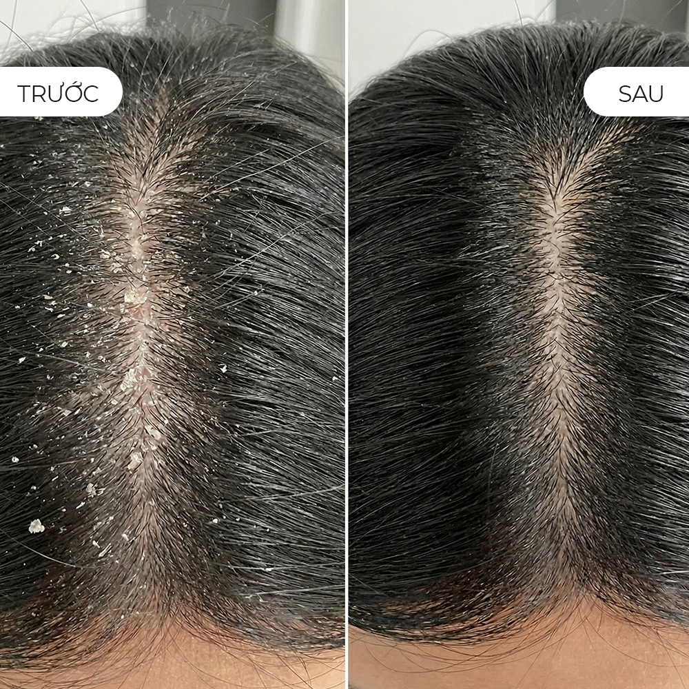  Dầu Gội Natufres Hawaiian Breeze Muối Biển & Trái Nhàu Hawaii 