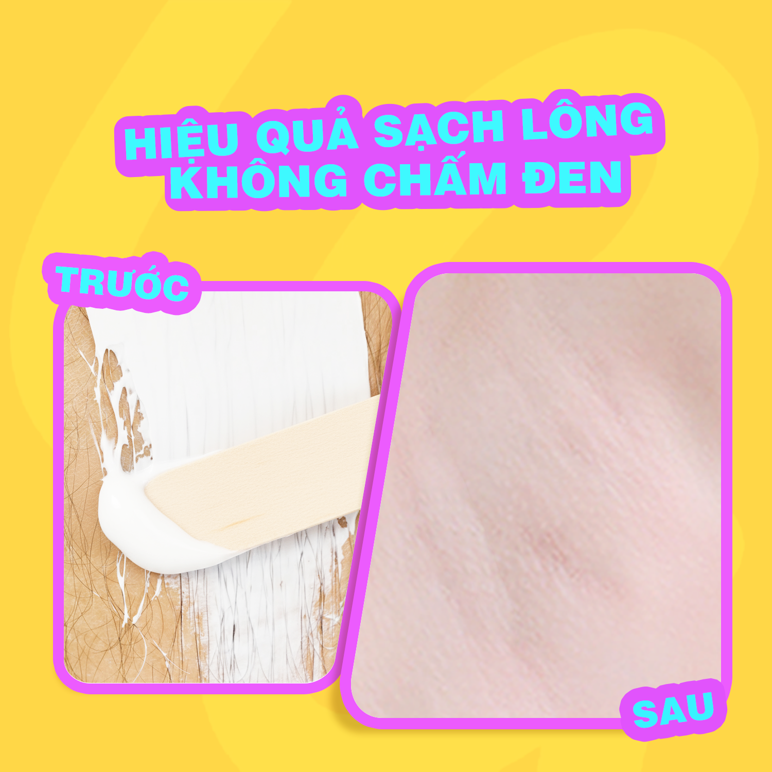  Combo Kem Tẩy Lông Viền Bikini Cleo 50g & Gel Dưỡng Dịu Da 20g 
