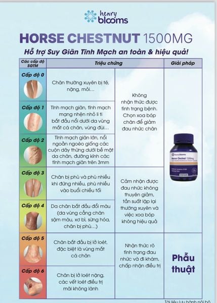 Henry Blooms Viên Uống Hỗ Trợ Giảm Giãn Tĩnh Mạch Hạt Dẻ Ngựa Horse Chestnut 1500mg 30 Viên