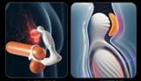  Máy Massage HM & Tuyến Tiền Liệt Nam Giới, Nhiều Tần Số Rung, SD App 