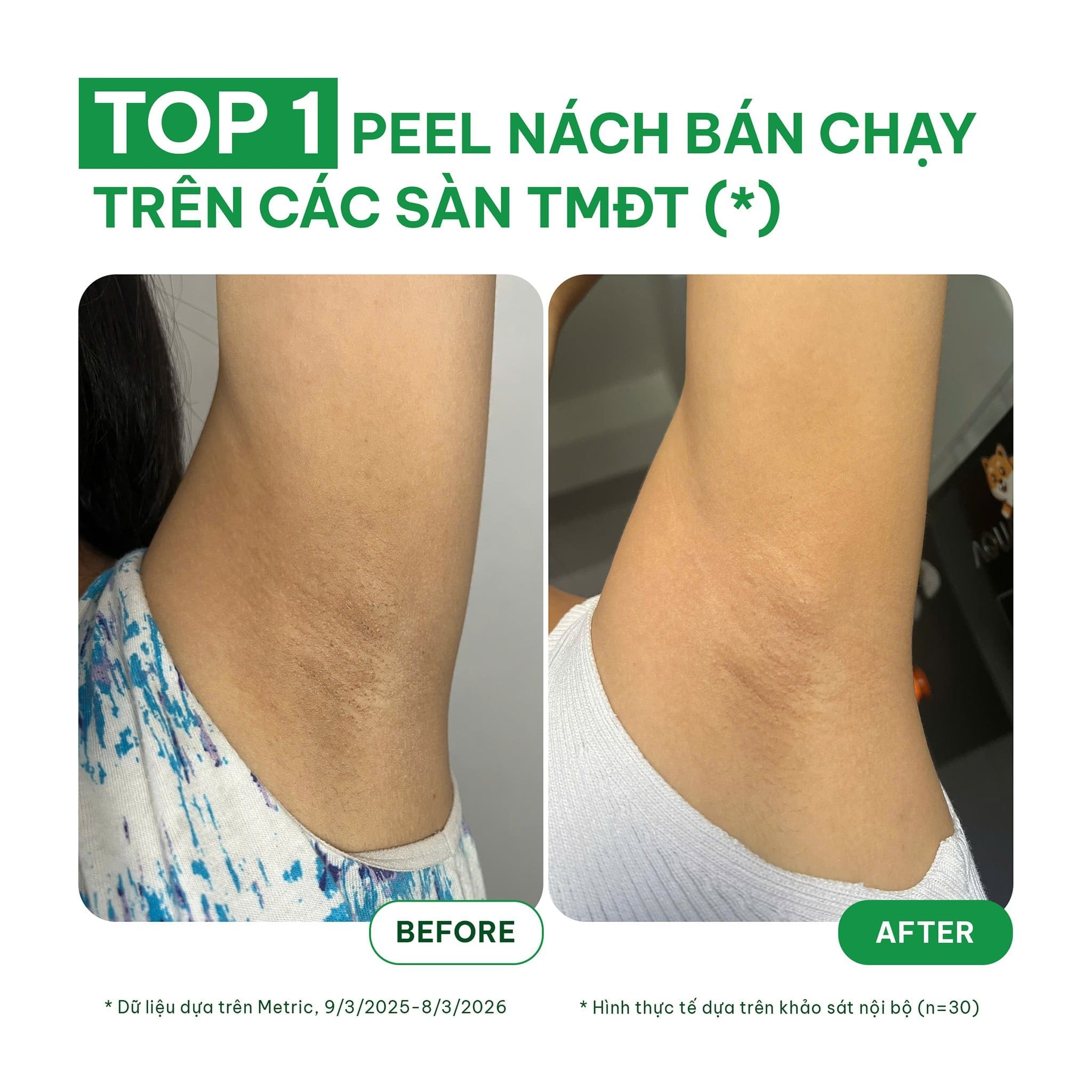  (Công thức mới) Tinh chất tẩy da chết cơ thể cho nách, bikini, đầu gối, khuỷu tay BareSoul Glowy Body Peel Solution 50g - 1.76 oz 