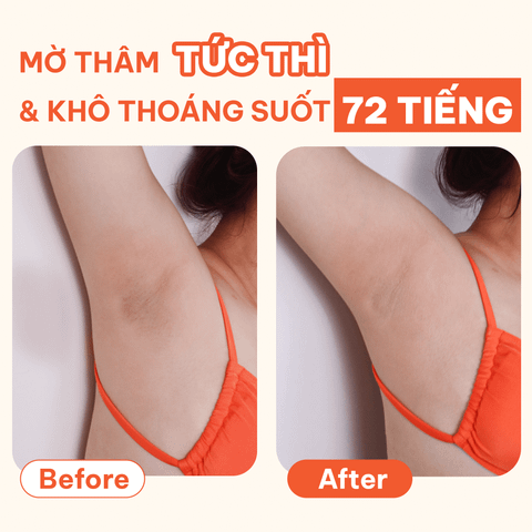  Sáp dưỡng sáng & che khuyết điểm, khử mùi BareSoul OMG Cam 15g - Che phủ tức thì - Giúp làm sáng vùng nách, đùi trong, bikini 