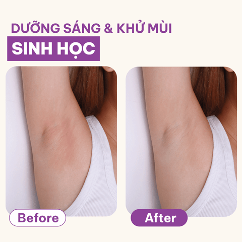  Sáp dưỡng sáng & khử mùi BareSoul OMG Tím 15g – Dành cho mẹ bầu và da nhạy cảm - Giúp làm sáng vùng nách, đùi trong, bikini 