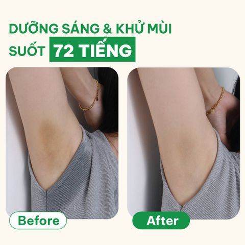  Sáp dưỡng sáng & khử mùi BareSoul OMG Xanh 15g – Dành cho người đổ mồ hôi nhiều- Giúp làm sáng vùng nách, đùi trong, bikini 