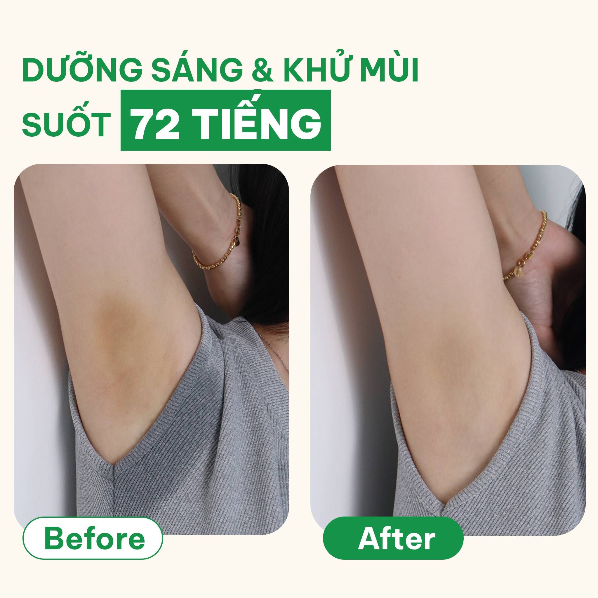  Sáp dưỡng sáng & khử mùi BareSoul OMG Xanh 15g – Dành cho người đổ mồ hôi nhiều- Giúp làm sáng vùng nách, đùi trong, bikini 