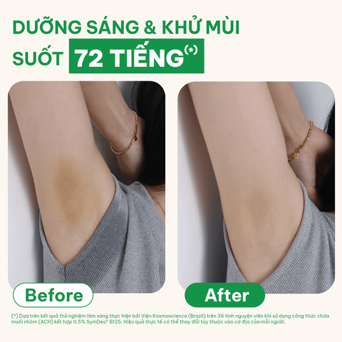  Sáp dưỡng sáng & khử mùi BareSoul OMG Xanh 15g – Dành cho người đổ mồ hôi nhiều- Giúp làm sáng vùng nách, đùi trong, bikini 