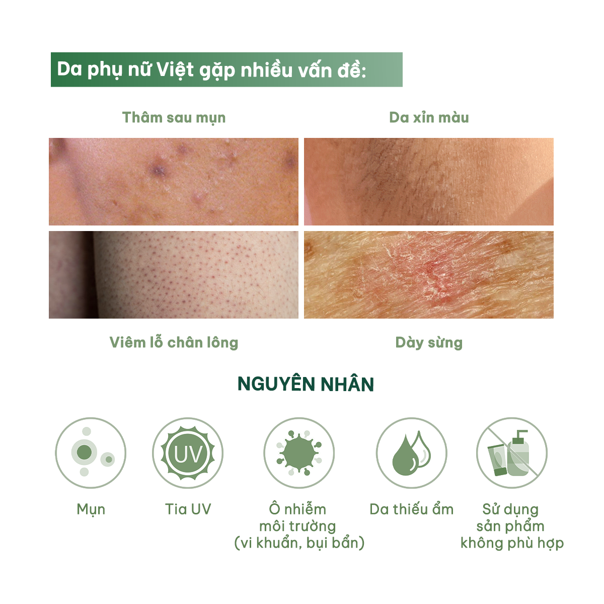  (Công thức mới) Tinh chất tẩy da chết cơ thể Glowy Body Peel Solution 50G 