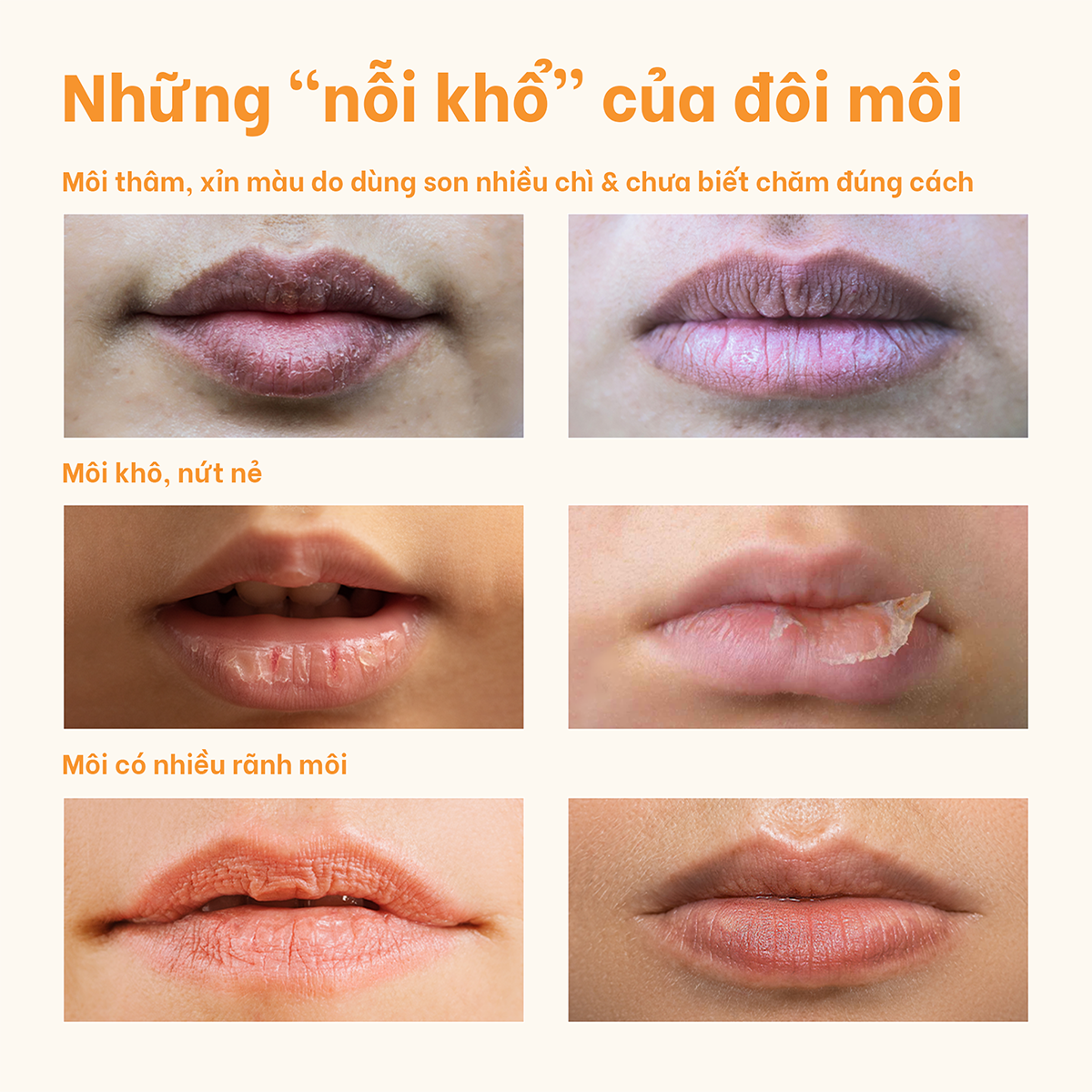  Mặt nạ ngủ cho môi kiêm son dưỡng Baresoul Best Kisser Lip Butter & Mask 10g 
