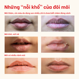  Son dưỡng có màu kiêm má hồng giúp làm hồng môi và má tự nhiên BareSoul Lip & Cheek Tint 10g 