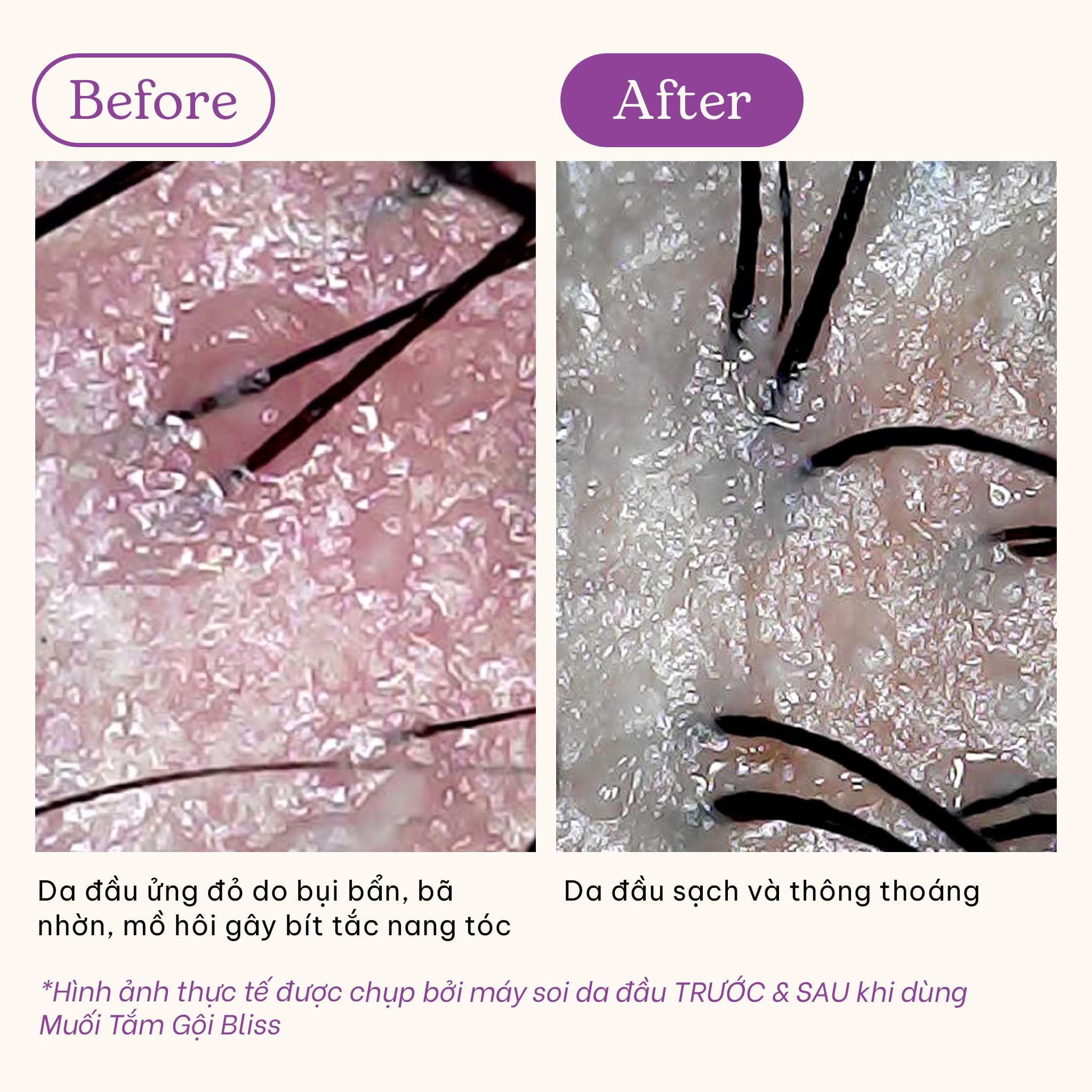  Muối tắm gội tím tẩy tế bào chết da đầu và body cho tóc tẩy nhuộm và da body khô, nhạy cảm Bliss BareSoul Salt Body & Scalp Scrub 330g - 11.64 oz 