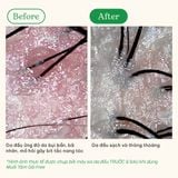  Muối tắm gội tẩy tế bào chết da đầu và body cho tóc bết và da body dầu, mụn Free BareSoul Body & Scalp Scrub 330g - 11.64 oz 