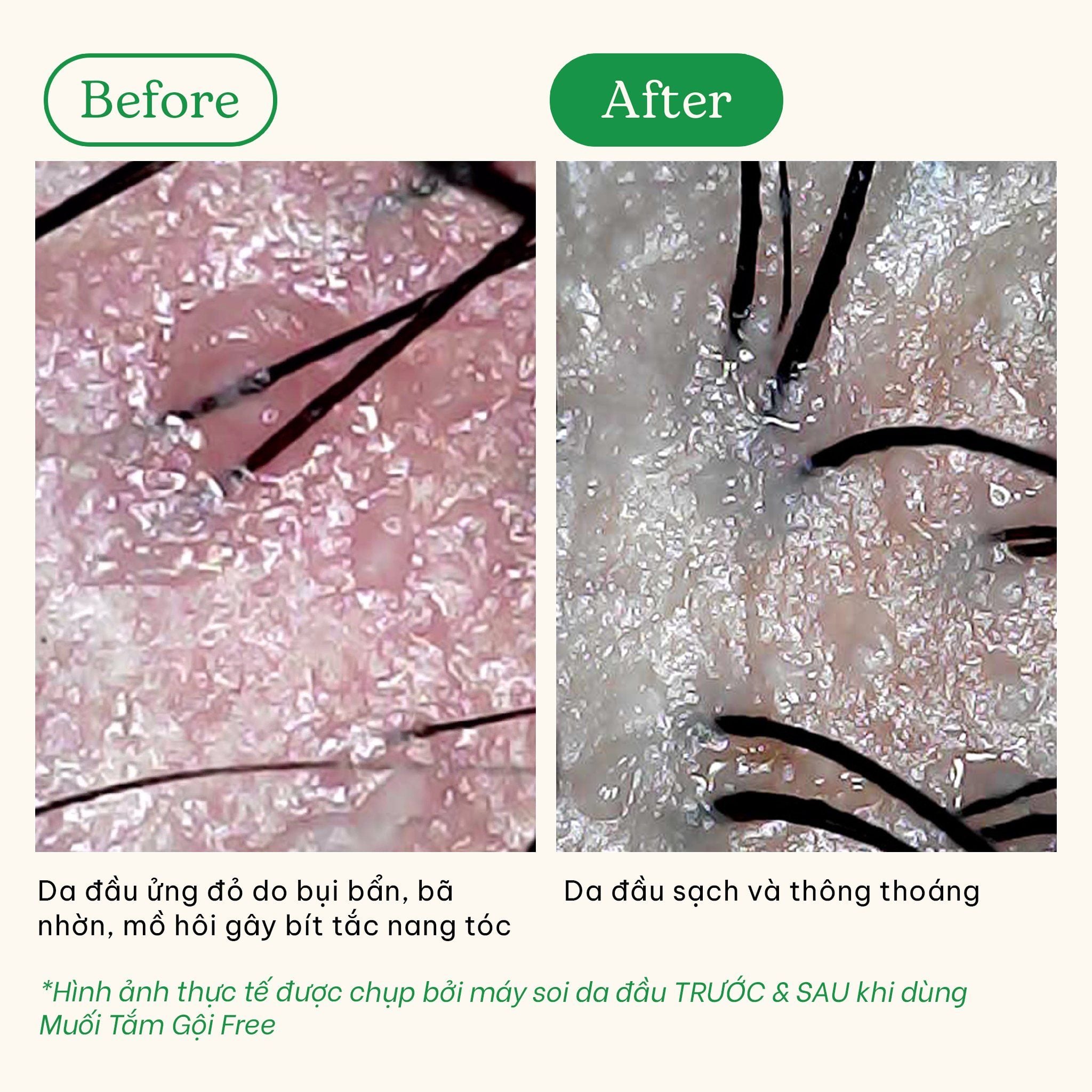  Muối tắm gội tẩy tế bào chết da đầu và body cho tóc bết và da body dầu, mụn Free BareSoul Body & Scalp Scrub 330g - 11.64 oz 