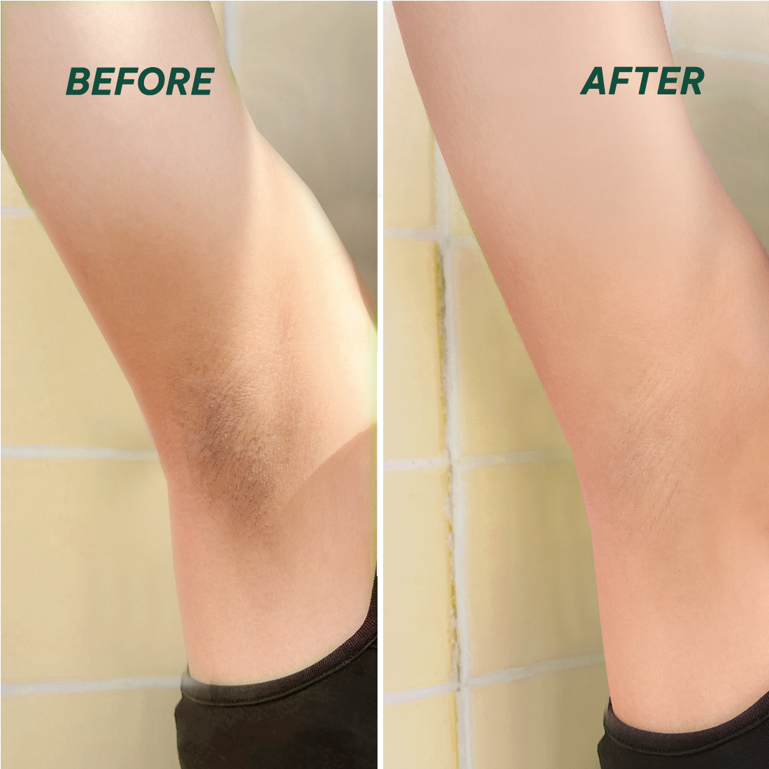  (Công thức mới) Tinh chất tẩy da chết cơ thể Glowy Body Peel Solution 50G 