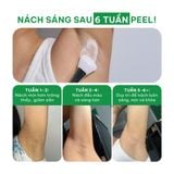  (Công thức mới) Tinh chất tẩy da chết cơ thể cho nách, bikini, đầu gối, khuỷu tay BareSoul Glowy Body Peel Solution 50g - 1.76 oz 