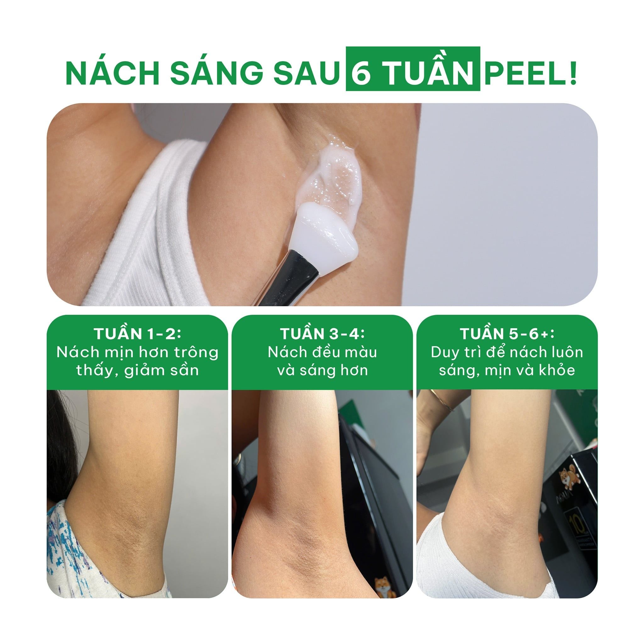  (Công thức mới) Tinh chất tẩy da chết cơ thể cho nách, bikini, đầu gối, khuỷu tay BareSoul Glowy Body Peel Solution 50g - 1.76 oz 