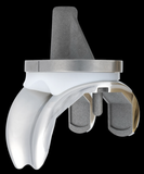  Freedom® Total Knee System 