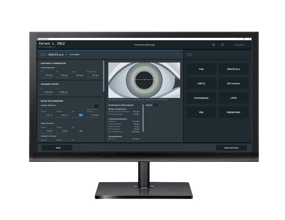  Zeiss Refractive workflow - Refractive workplace 