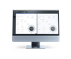  Zeiss Cataract workflow - EQ workplace 