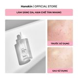  Tinh Chất Dưỡng Sáng Da Hanskin Clearing Niacin Ampoule 50ml. 