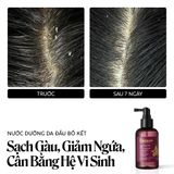  Combo 2 Nước Dưỡng Da Đầu Bồ Kết Cocoon Gleditsia Scalp Tonic 140ml. 