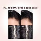  Dầu Gội Ngăn Ngừa & Giảm Gãy Rụng Tóc L’Oreal Paris Resist Anti Hair Fall Shampoo 440ml. 
