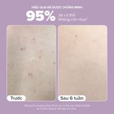  Kem Dưỡng Thể Giúp Loại Bỏ Tế Bào Chết Và Mềm Mịn Da 2% Bha Paula'S Choice 2% Bha Body Smoothing Spot Exfoliant 210ml. 