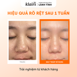  Nước Hoa Hồng Sáng Da Dear, Klairs  Freshly Juiced Vitamin Essence Toner 180ml. 