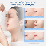  Mặt Nạ Bnbg Cấp Ẩm Đa Tầng, Căng Bóng Da Skin Booster Pdrn Hydrating Mask 30ml 