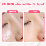  Mặt Nạ Đất Sét Quả Mọng Thải Độc Làm Sáng Da Aperire Relief Berry Pretty Pore Mask 120g. 