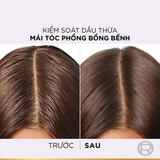  Dầu Xả Dành Cho Da Đầu Dầu L’Oréal Paris Elseve Hyaluron Pure 72H Purifying Conditioner 375ml 