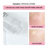  Tinh Chất Dưỡng Sáng Da Hanskin Clearing Niacin Ampoule 50ml. 