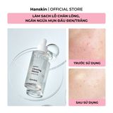  Tinh Chất Dưỡng Sáng Da Hanskin Clearing Niacin Ampoule 50ml. 