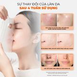  Mặt Nạ Trẻ Hóa Phục Hồi Da Bnbg  Placenta Relaxing Skin Booster Mask 30ml. 