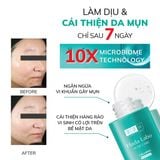  Serum dưỡng ẩm cho da mụn, nhạy cảm HADA LABO ACNE CARE CALMING SERUM 30ml 