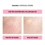  Toner Pad Cấp Ẩm Làm Dịu Da Hanskin Real Complexion Hyaluron Relief Toner Pad 210ml. 