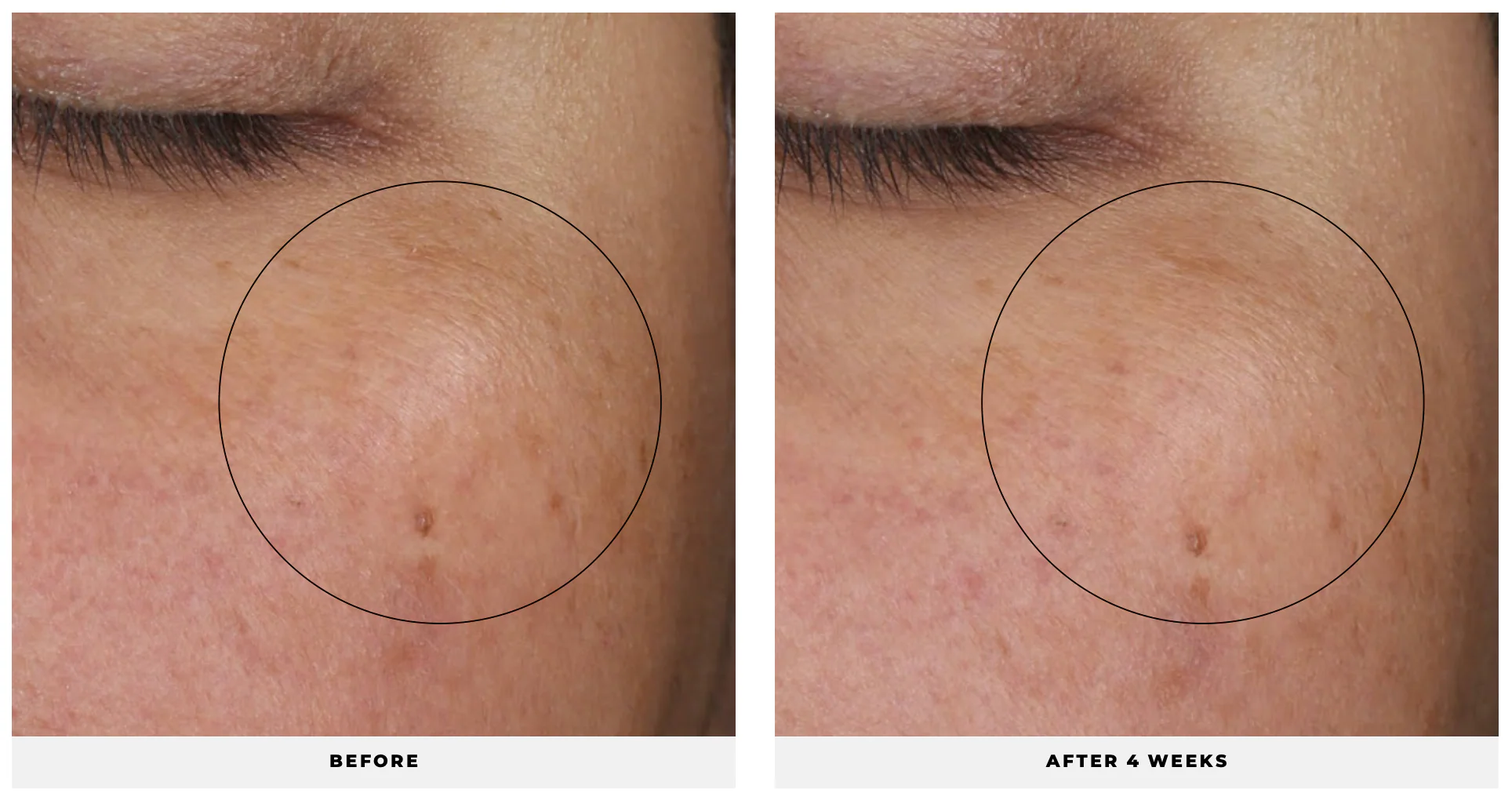  COMPLEXION RENEWAL OIL - Dầu dưỡng da phục hồi chống lão hóa da 30ml 