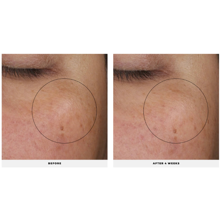  Complexion Renewal Oil 