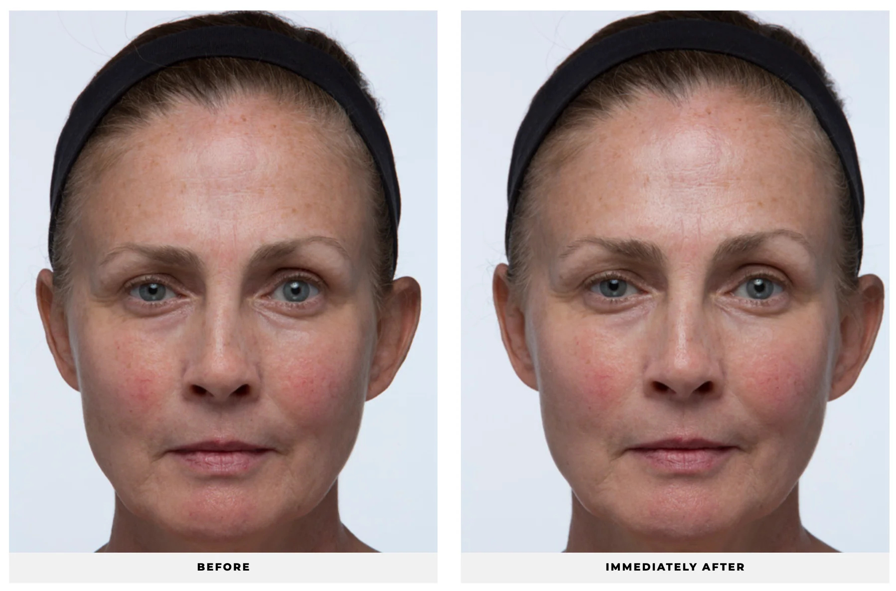  Ultra Replenishing Sunscreen 