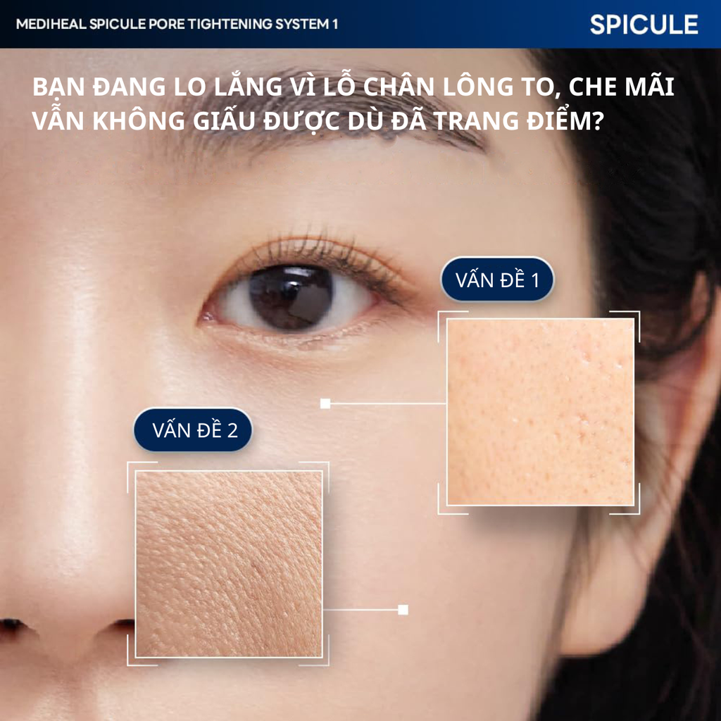 Mặt Nạ Thạch Dưỡng Ẩm Săn Chắc Da Thu Nhỏ Lỗ Chân Lông Mediheal Spicule Pore Tightening System 2
