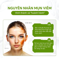 Gel Chấm Mụn Floslek Anti Acne 24h System Spot Gel For Imperfections 20ml