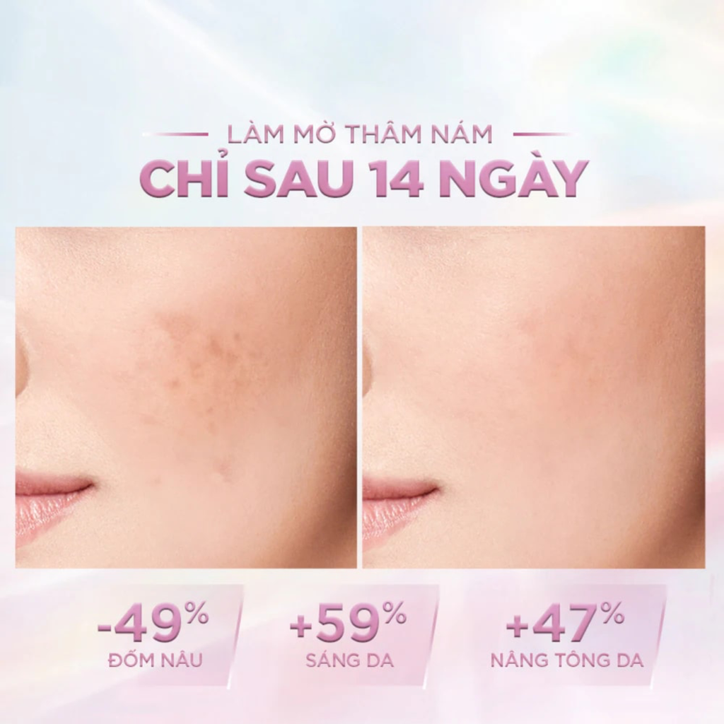 Kem Dưỡng Sáng Da Mờ Thâm Nám Ban Ngày Loreal Glycolic-Bright Glowing Cream Day SPF30 50ml