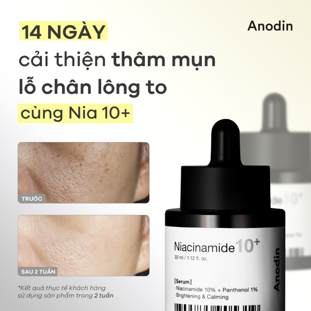 Tinh Chất Dưỡng Trắng Thu Nhỏ Lỗ Chân Lông Anodin Niacinamide 10 Plus Serum 33ml