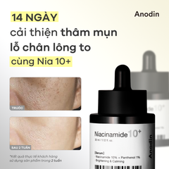 Tinh Chất Dưỡng Trắng Thu Nhỏ Lỗ Chân Lông Anodin Niacinamide 10 Plus Serum 33ml
