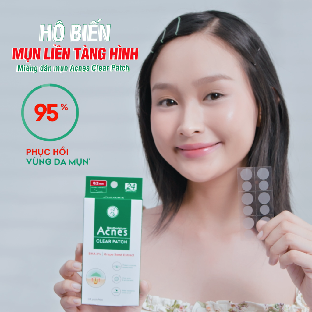 Miếng Dán Mụn Giảm Mụn Sưng Viêm Acnes Clear Patch 24 Miếng
