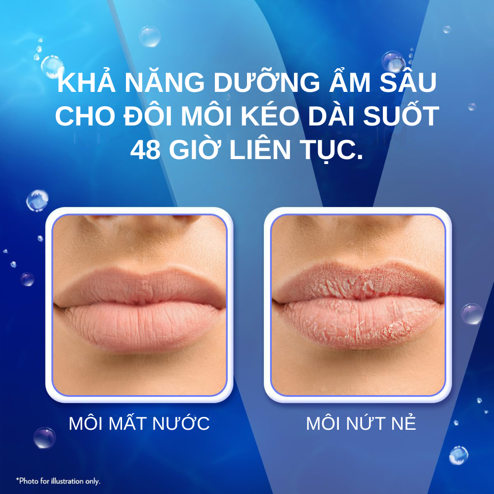 Son Dưỡng Vaseline Lip Therapy 9.6g