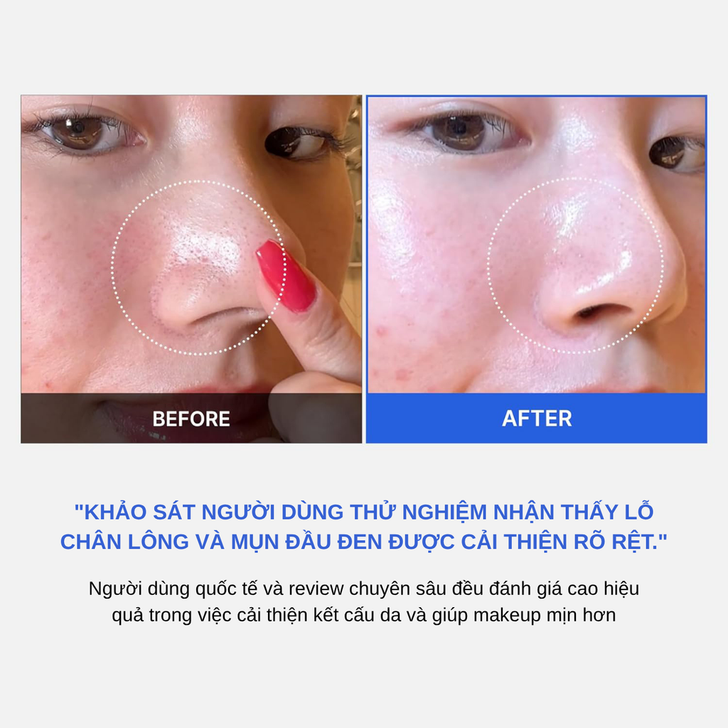 Toner Pad Thu Nhỏ Lỗ Chân Lông Mềm Mịn Da Medicube Zero Pore Pad 70 Miếng