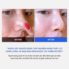 Toner Pad Thu Nhỏ Lỗ Chân Lông Mềm Mịn Da Medicube Zero Pore Pad 70 Miếng